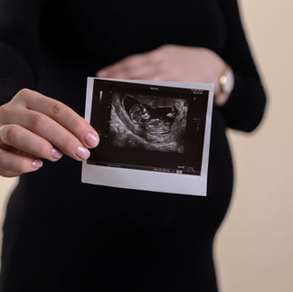 woman with an ultrasound