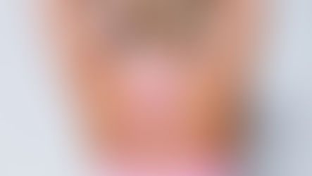 Myalgie verstehen – Ursachen, Symptome und effektive Ansätze zur Linderung von Muskelschmerzen