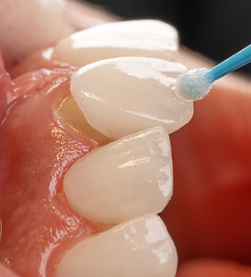 Patient smile and dental care at Zay Zub