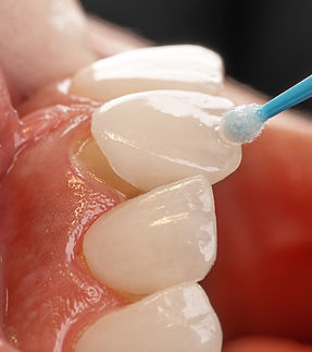 Image by Kamal Hoseinianzade