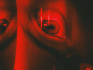 Eales Disease: Understanding This Rare Inflammatory Eye Condition