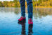 Cold days, cold feet & chilblains