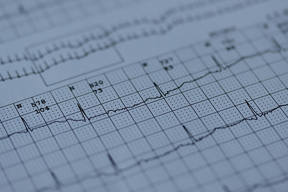 Image by Joachim Schnürle