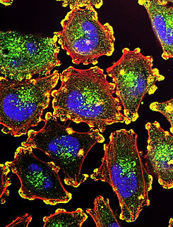 Cells replicating on fluoroscopy.