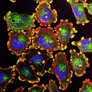 The Eukaryotic Cell: Differences Between the Animal and Plant Kingdoms