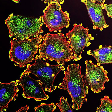 Image by National Cancer Institute