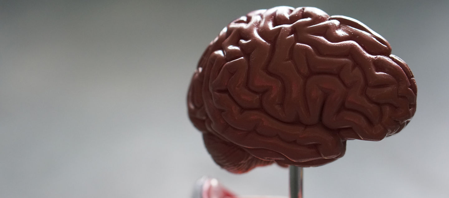 A cinematic brain on a stand, symbolising innovative thinking and mental dominance.