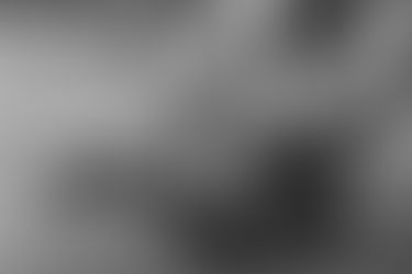 Understanding and Managing Heel Pain from Achilles Tendon Injuries