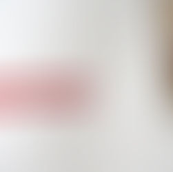 Avoiding Common SEO Mistakes: Lessons From Real-World Campaigns