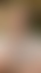 CAÍDA DEL PELO EN HOMBRES: CAUSAS, HÁBITOS QUE LA EMPEORAN Y CÓMO FRENARLA