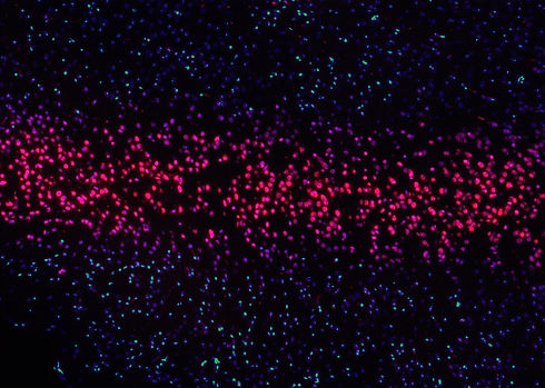 Image by National Cancer Institute