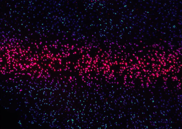 Image by National Cancer Institute