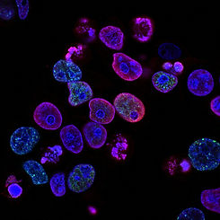 Image by National Cancer Institute