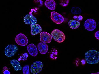 Exosomes