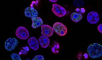 Image by National Cancer Institute