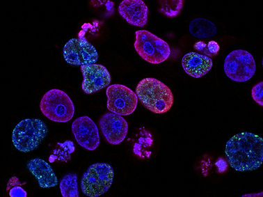 Image by National Cancer Institute