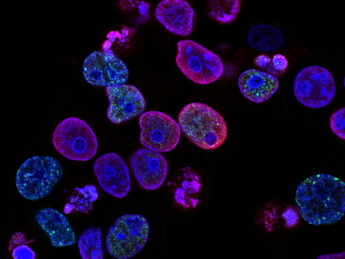 The Cancer Resistance in Naked Mole Rats