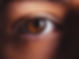 Macular Degeneration