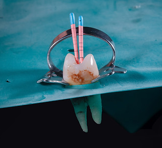 Wurzelbehandlung, Endodontologie