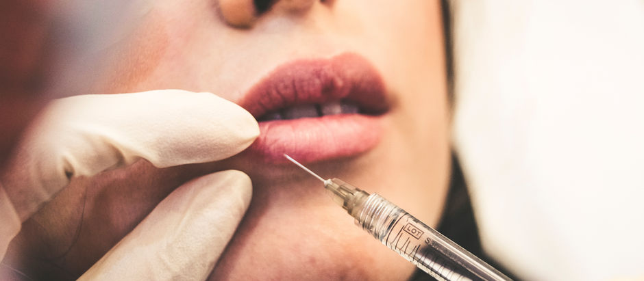 Close-up of a syringe near lips for cosmetic injection. Gloved hand holds the needle. Soft lighting, neutral background, focused on lips.