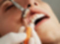 Professional oral cancer screening performed by Spainhower Dental Care team in Layton, Utah for early detection and prevention