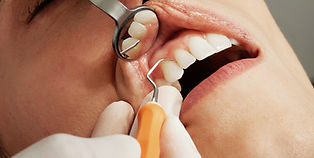 limpeza dental