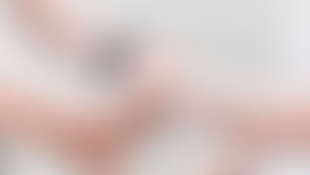 Ganglion am Handgelenk: Ursachen, Symptome und Behandlung – muss ein Überbein operiert werden?