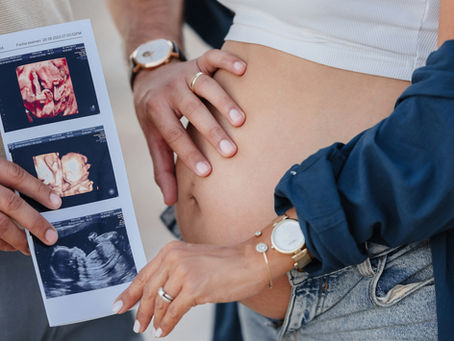 pregnancy and ultra sound pictures represent IVF and surrogacy with ACRC global surrogacy