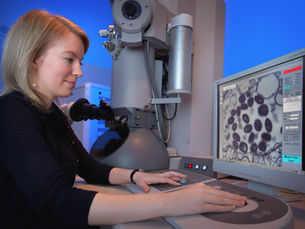 Mulher de cabelo loiro, vestida de escuro, observa através de um microscópio eletrónico; ao lado, um monitor mostra células ampliadas coradas de roxo.