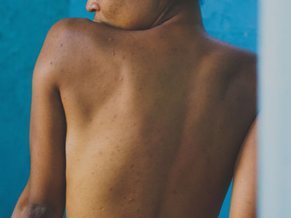 Body talk: Brits reveal their most common body insecurities - and why they keep them from the beach, the bedroom, and the doctor