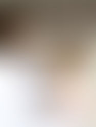 Cystic Fibrosis: pathophysiology and the vital role of Medical professionals