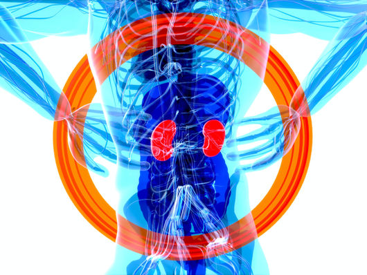 Calcoli Renali ed Urinari: Conoscere le Cause, Affrontare il Dolore