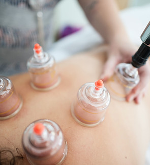 Cupping