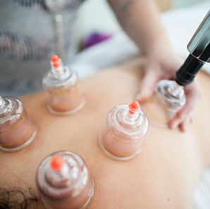 Cupping Therapy