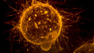 Exploring the Breast Cancer Dataset with Python and Scikit-learn(sklearn)