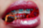 Close up of female lips and teeth with braces chewing on a piece of candy