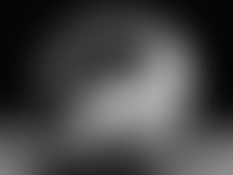 ADHD vs. Bipolar Disorder: Why an Accurate Diagnosis Matters