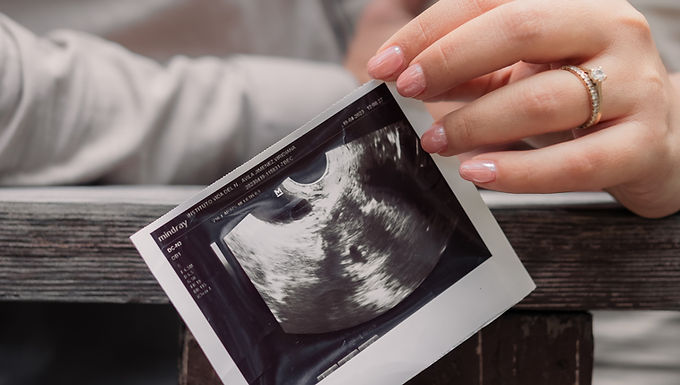 Abortion Techniques
