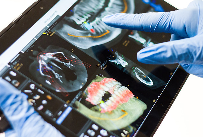 Planejamento digital de implantes dentários com tecnologia tridimensional para cirurgia guiada na Piochi Odontologia.