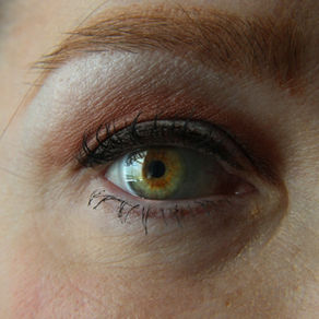 Occhi arrossati: quali sono le cause e i rimedi?