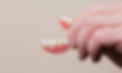 Partial Dentures Tempe, AZ