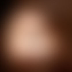 Blefaroplastia (cirurgia das pálpebras)