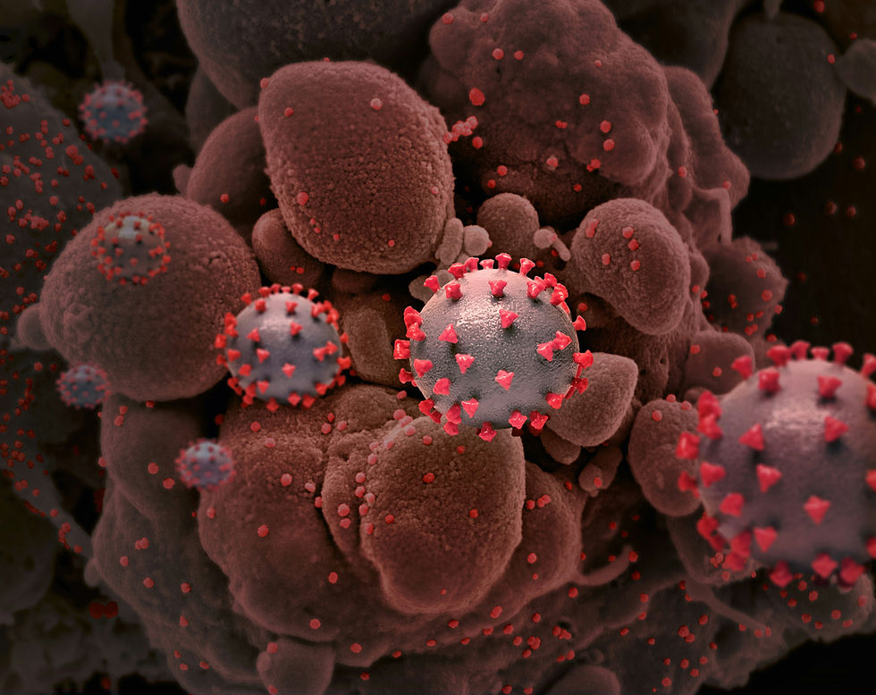 Image by National Institute of Allergy and Infectious Diseases