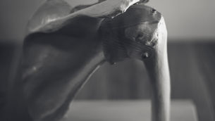 Rotatorenmanschettenriss – Ursachen, Symptome und Therapieoptionen