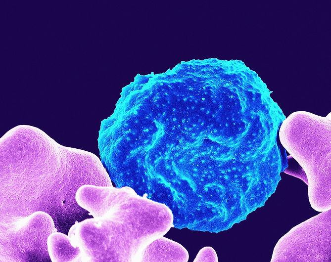 Image by National Institute of Allergy and Infectious Diseases