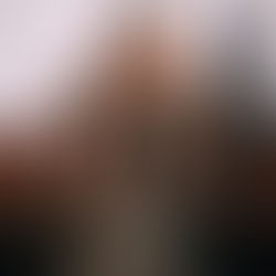 Дрон повредил Пулковскую обсерваторию в Петербурге