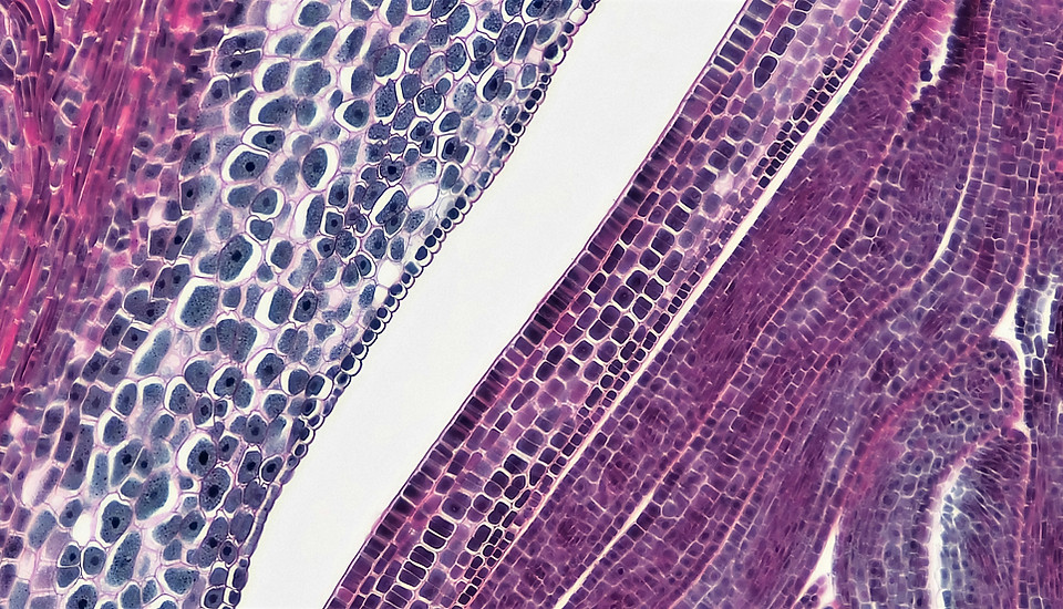 Image by Bioscience Image Library by Fayette Reynolds