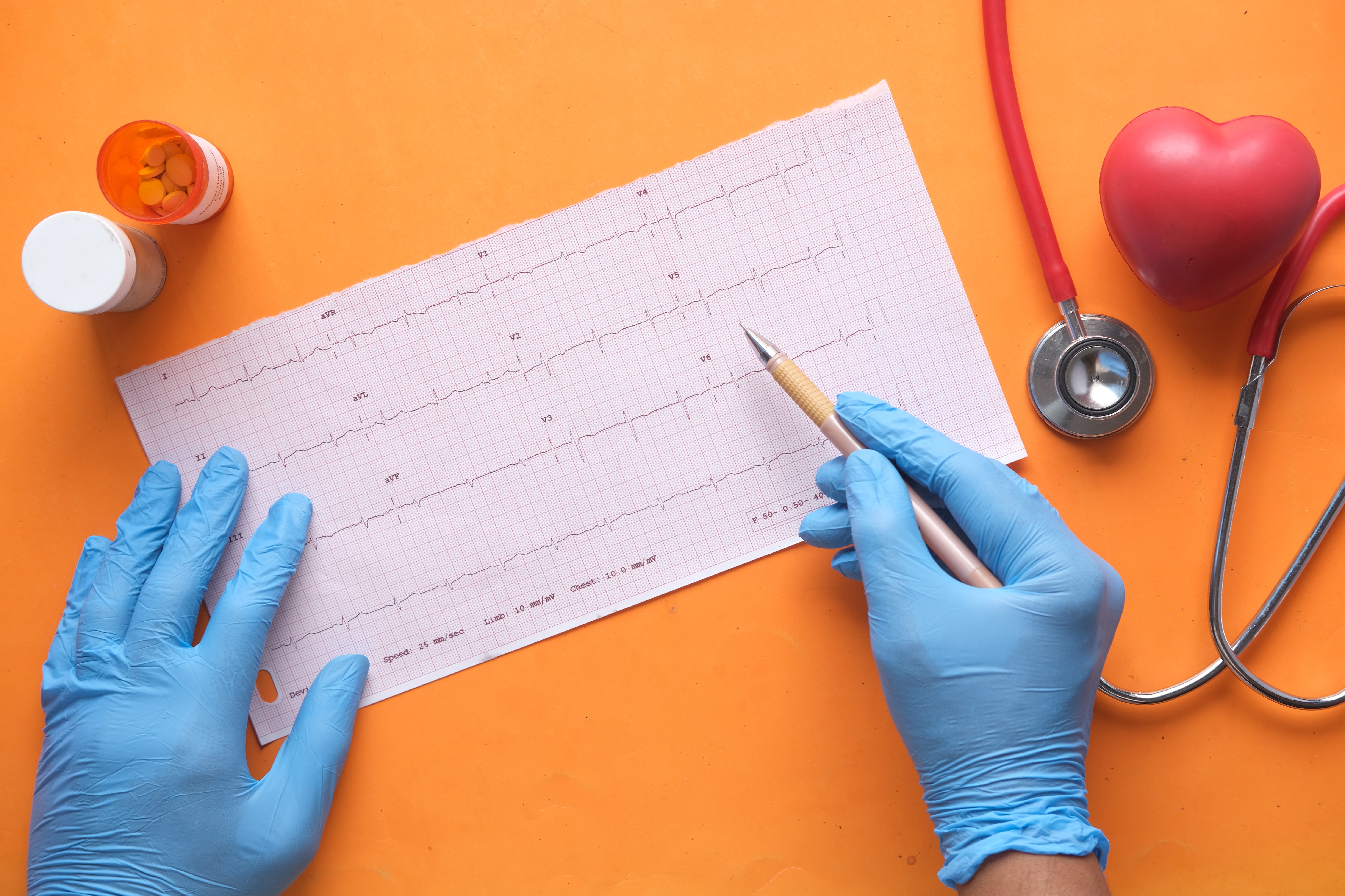 Why Is My Heart Racing? Understanding Palpitations in Women 30+