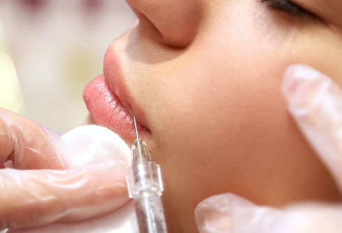 Botox & Fillers for Allswell Wellness LLC Image by Vlad Egorov