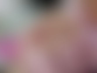 Skin Boosters: The secret to radiant, hydrated skin 